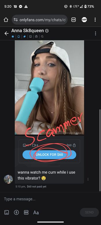 🔥 Annaoswald  page leaked private photo uncensored full