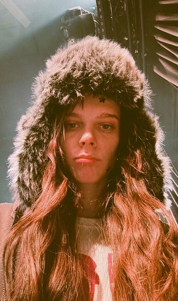 🔥 Ashley matheson smashedely  page leaked private photo uncensored full