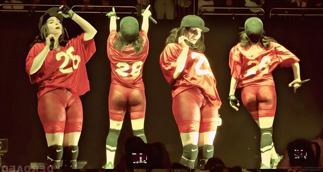 🔥 Billie eilish  page leaked private photo uncensored full