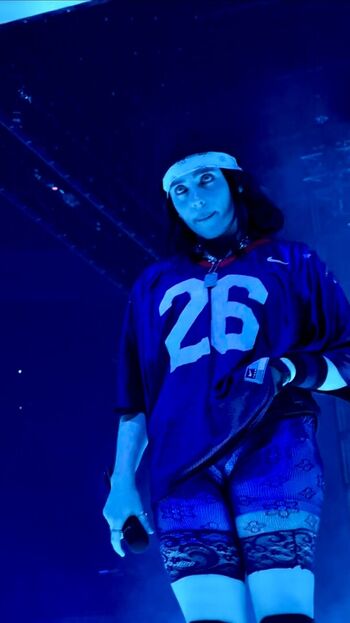 🔥 Billie eilish  page leaked private photo uncensored full