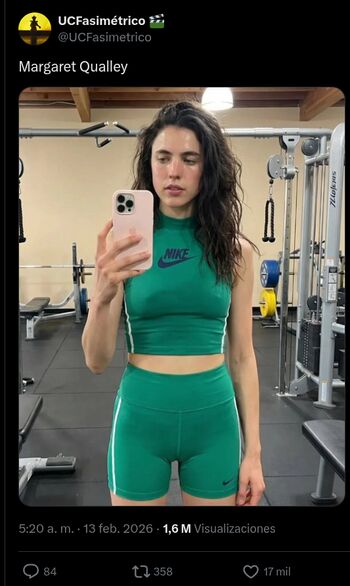 🔥 Billie eilish  page leaked private photo uncensored full