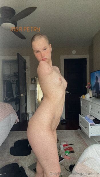 🔥 Disabled girls page leaked private photo uncensored full