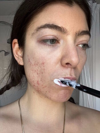 🔥 Lorde  page leaked private photo uncensored full