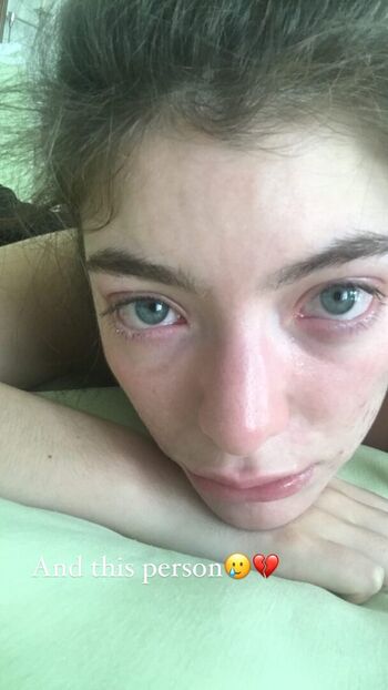 🔥 Lorde leaked private photo uncensored full