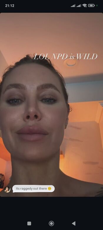 🔥 Nicole aniston  page leaked private photo uncensored full