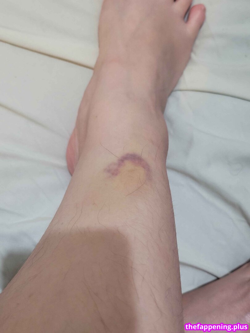 🔥 Page/ leaked private photo uncensored full