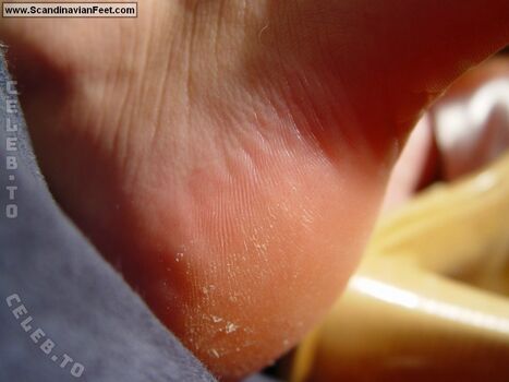 🔥 Scandinavian feet page leaked private photo uncensored full