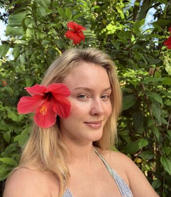 🔥 Zara larsson  page leaked private photo uncensored full