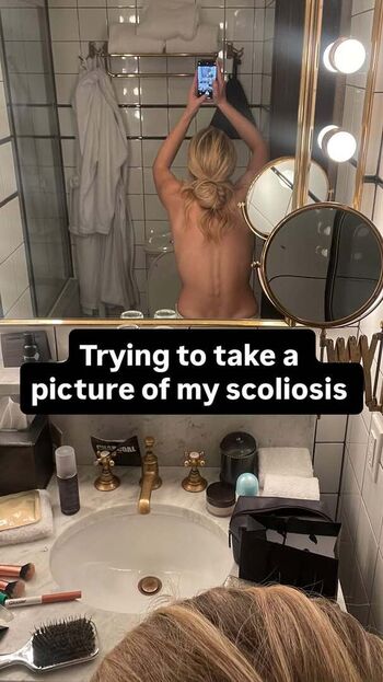 🔥 Zara larsson  page leaked private photo uncensored full